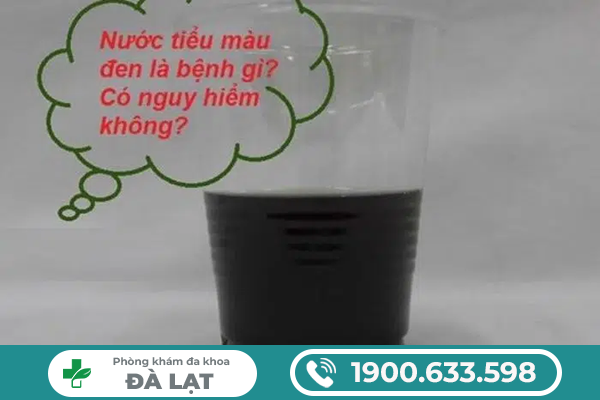 Hình ảnh minh họa